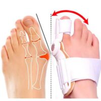 Corretor de Joanete Articulado Para Dia e Noite Hallux