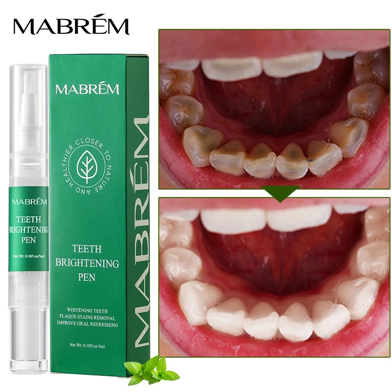 caneta-dental-clareadora-smilly-nobrestilo_06