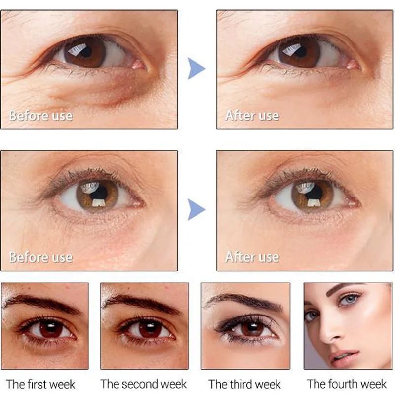 serum-rejuvenescedor-anti-rugas-e-olheiras-radiant-eyes-nobrestilo_01